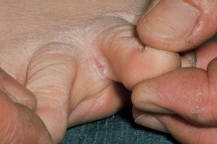 Anerer sprooch liesen